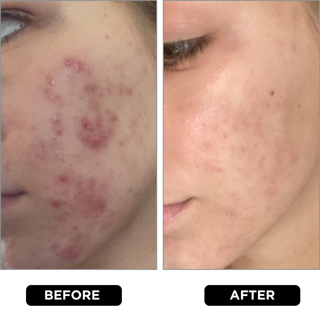 Customer Review Image 1